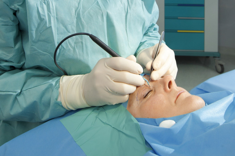 A medical professional in surgical gloves is performing a procedure near a patient's eye, using precise instruments. The patient is lying down and covered with blue surgical drapes, while the surrounding area is equipped for a sterile environment.